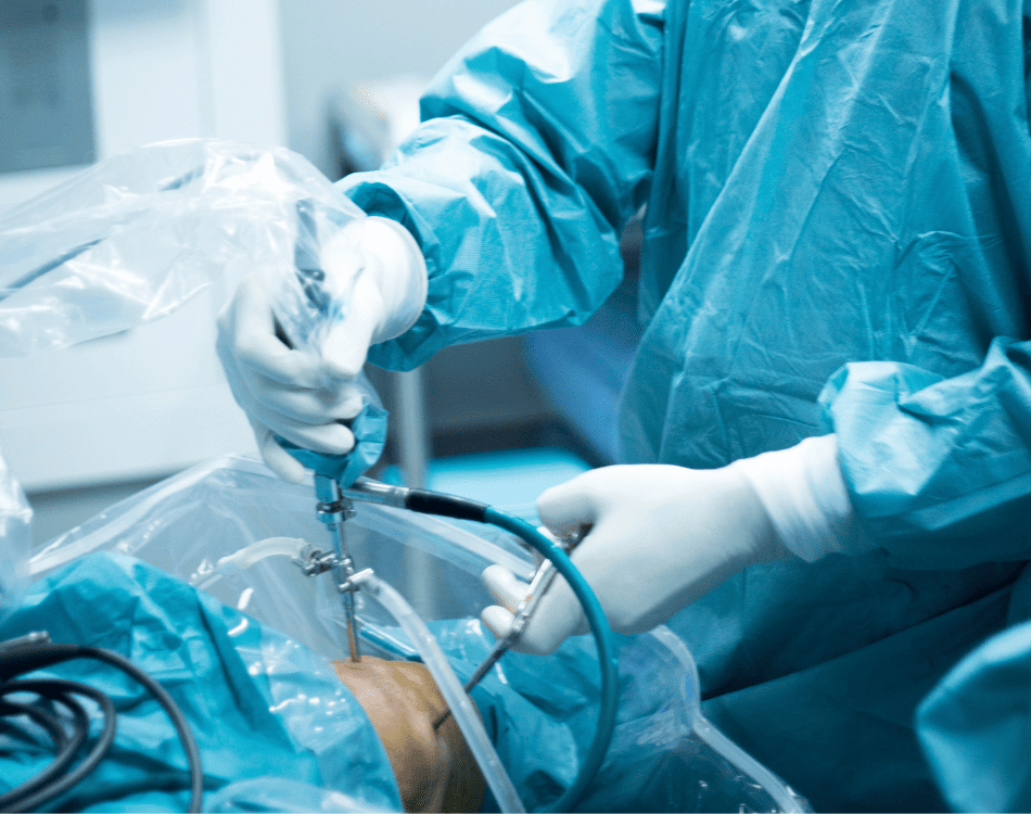 Artroscopia de rodilla